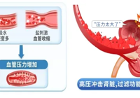 【世界腎臟日】武寧縣總醫(yī)院人民醫(yī)院院區(qū)腎內(nèi)風(fēng)濕內(nèi)分泌科：您的腎臟健康嗎？早檢查，保健康