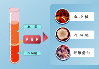 【新技術(shù)】武寧縣總醫(yī)院人民醫(yī)院院區(qū)骨科：富血小板血漿（PRP）注射療法